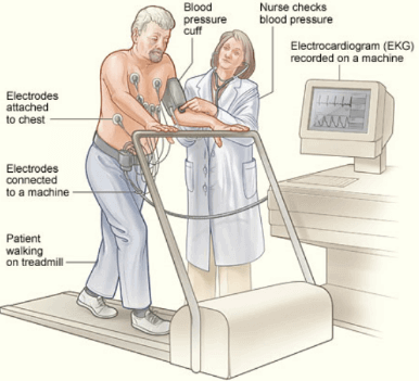 Stress test. The image shows a patient having an exercise stress test. Electrodes are attached to the patient’s chest and connected to an electrocardiogram (EKG) machine. The EKG records the heart’s electrical activity. A blood pressure cuff records the patient’s blood pressure while he walks on a treadmill.